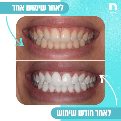 ™Fresh360 - לצחצוח שיניים מהיר ואפקטיבי